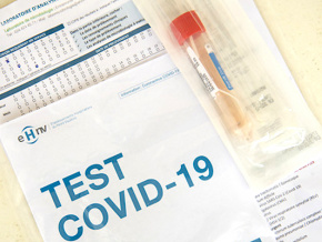 Le coût du test PCR Covid-19 est désormais à 25 000 FCFA