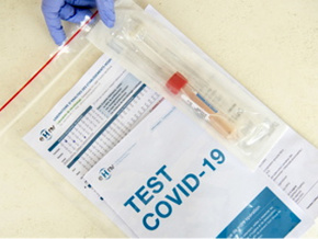 La Cedeao fixe à 27 000 FCFA, le coût du test PCR pour les déplacements dans la sous-région